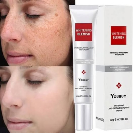 YOUBUY Whitening Blemish 20g Best Selling